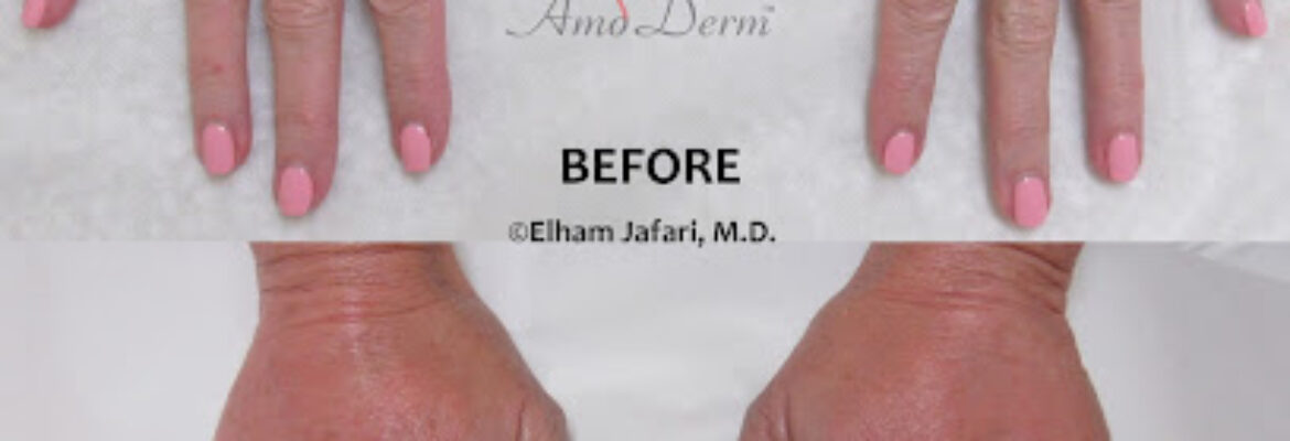 Amoderm Cosmetic and Wellness Medical Center
